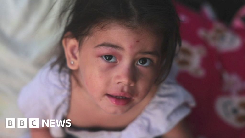 Venezuela earthquakes: Inside the country club now a makeshift hospital | ACTPnews