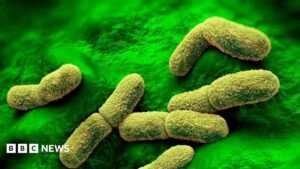 US ‘watching closely’ after plague researcher dies in Russia | ACTPnews